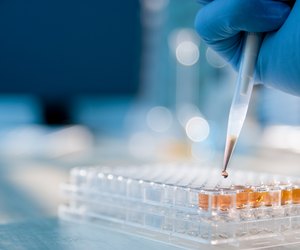 Lab Experiment