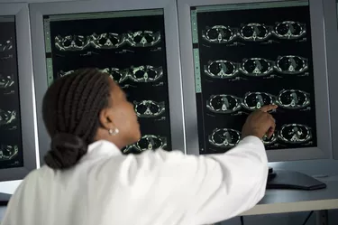 Female doctor pointing at MRI monitoring screen