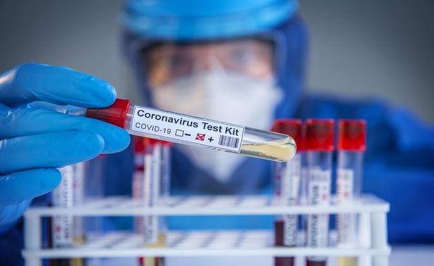 Examining coronavirus COVID 19 medical samples on kits novel corona virus outbreak