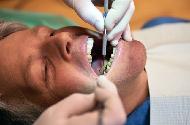 Tooth Cleaning